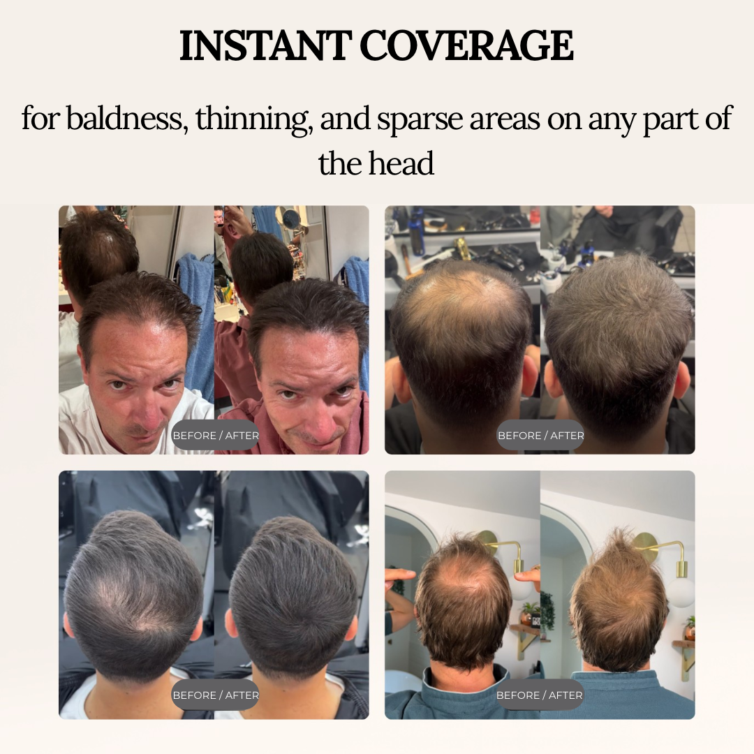 DERMACAP Stick – Instant Bald Cover