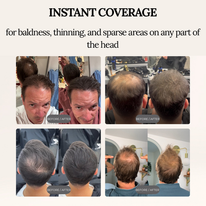 DERMACAP Stick – Instant Bald Cover