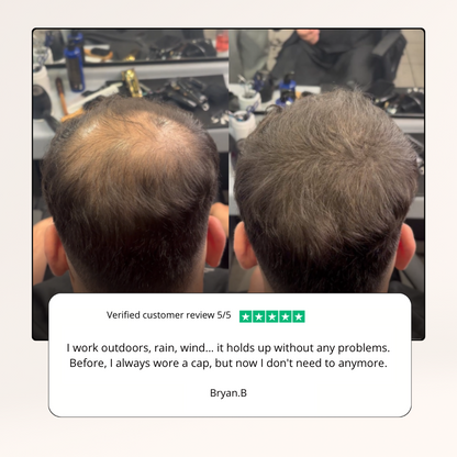 DERMACAP Stick – Instant Bald Cover